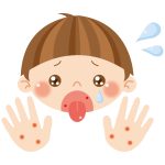手足口病　流行中